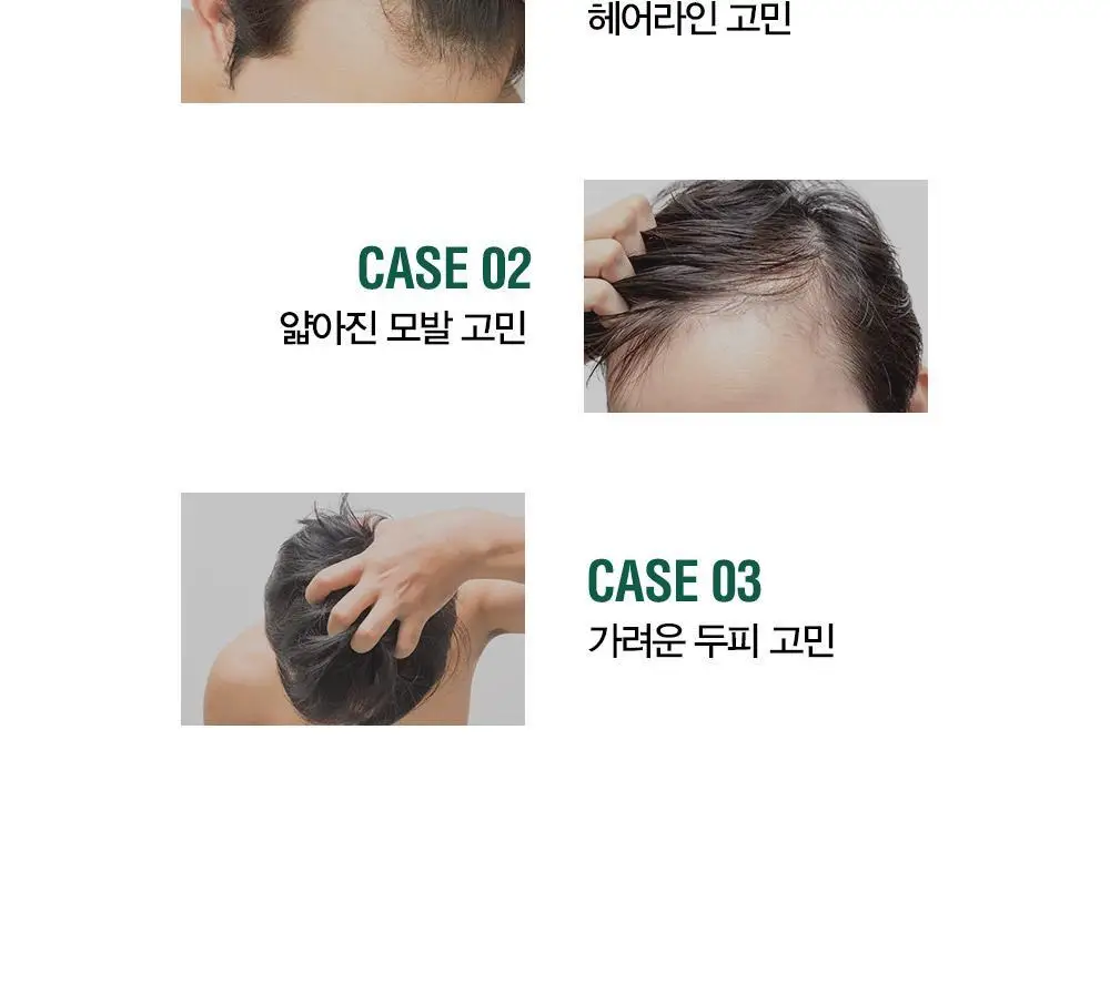 [변우석 Pick]다슈 안티헤어로스 허브 헤어토닉 150ml (탈모증상완화도움 기능성) 상세페이지 5